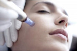 Microneedling - 3 facials for $700