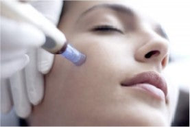 Microneedling - 3 facials for $700